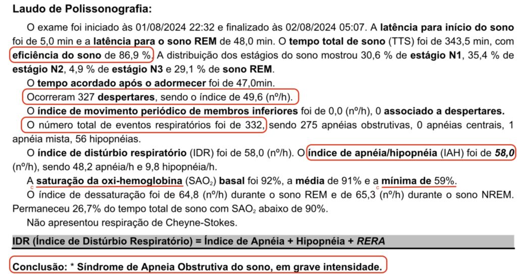 Laudo_polissonografia 